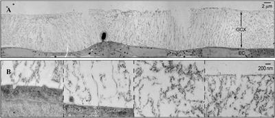 Glycocalyx Impairment in Vascular Disease: Focus on Inflammation